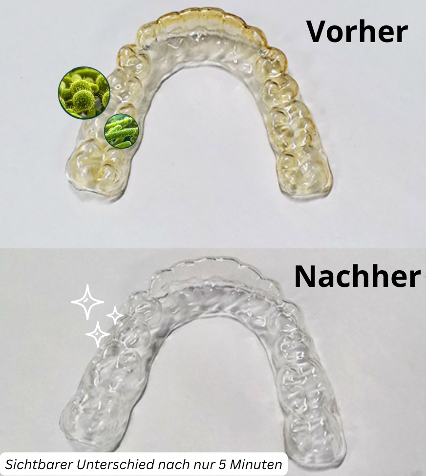 Spangen und Gebiss Ultraschallreinigungsgerät