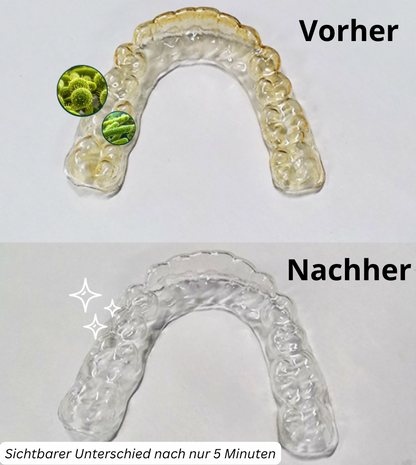Spangen und Gebiss Ultraschallreinigungsgerät